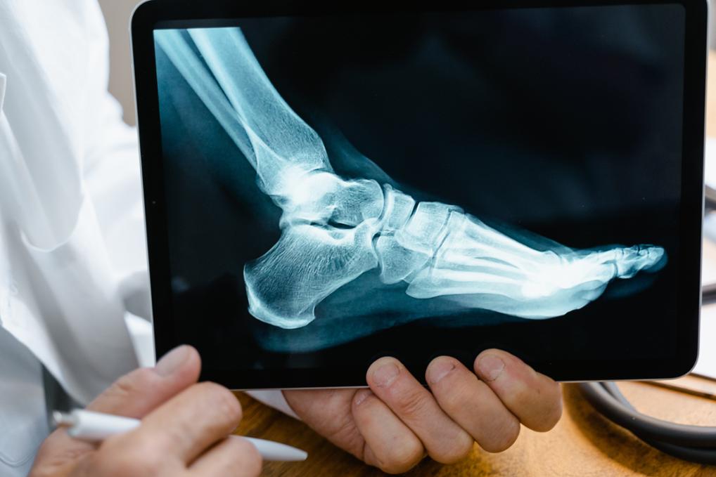 https://www.txhes.com/_resources/images/newsroom-resources/stock-photos/foot-xray-h1.jpg
